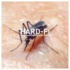 Hard-Fi – Sweating Someone Else’s Fever